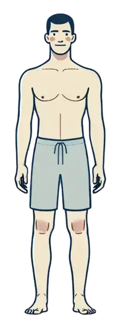 Področja obravnave na telesu